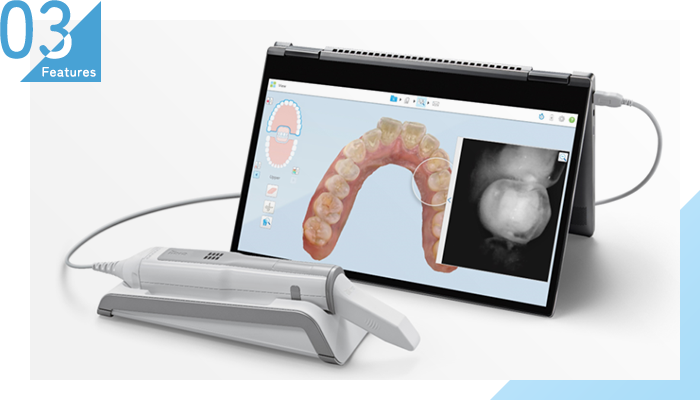 iTero element 5D(口腔内スキャナー)より 歯型の採取が負担なく精密に可能